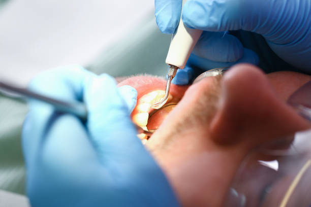 Best Broken or Cracked Tooth Emergency Dentist in Ravenna, MI