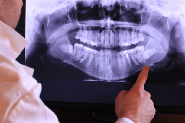 Best Emergency Dentist for Special Needs Patients in Ravenna, MI