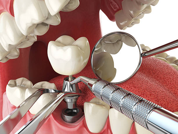 Best Emergency Dental Services for Seniors in Ravenna, MI
